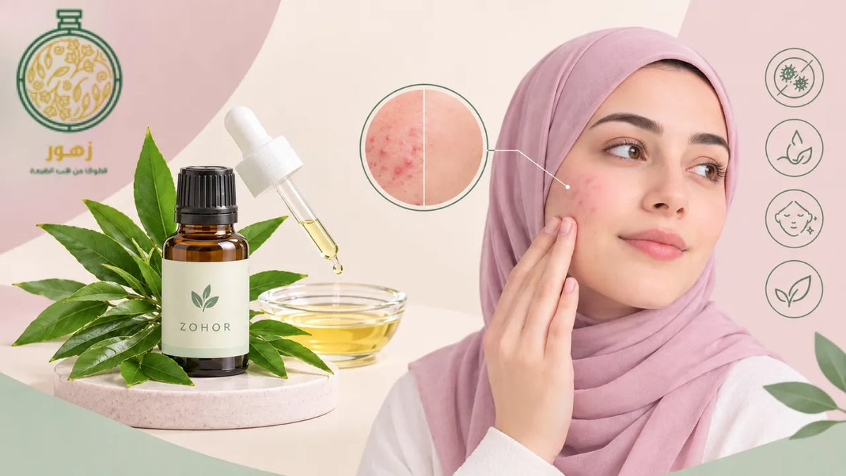 افضل زيت عطري لعلاج حب الشباب